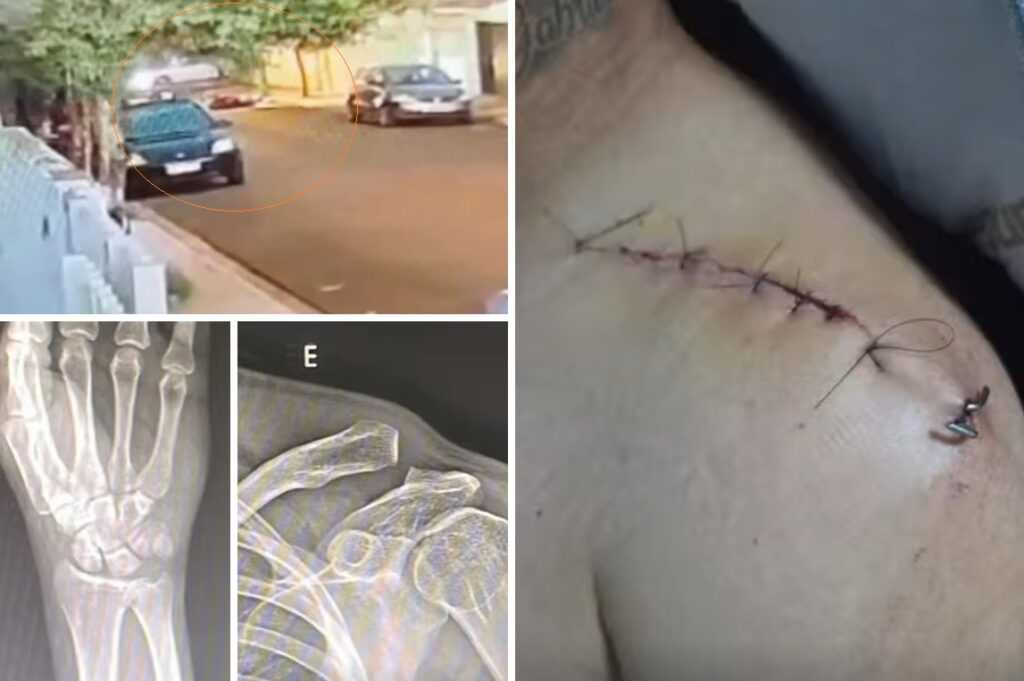 motociclista fica gravemente ferido apos enroscar em fiacao solta em votuporanga 